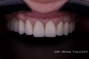 irina-tulchiy-stomatolog-odesa-19